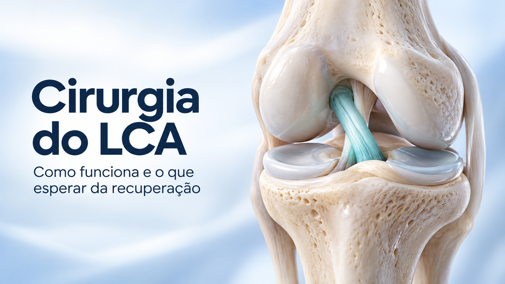 Cirurgia do LCA: como funciona e o que esperar da recuperação